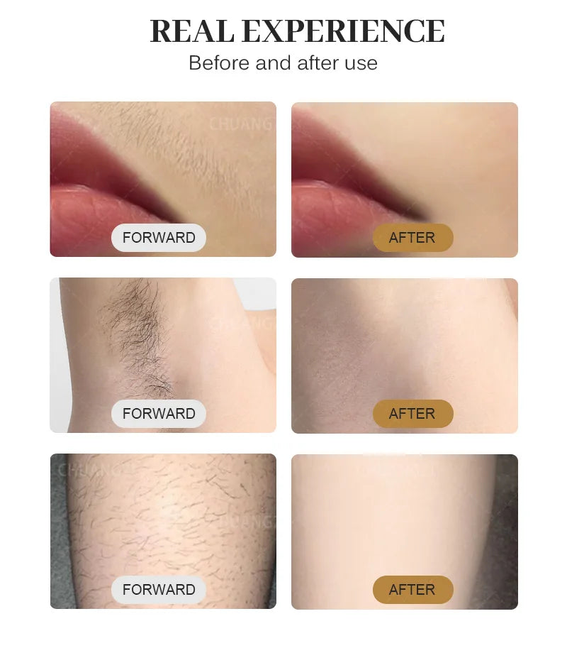 Viral Vault™ Professional Hair Removal Laser Machine