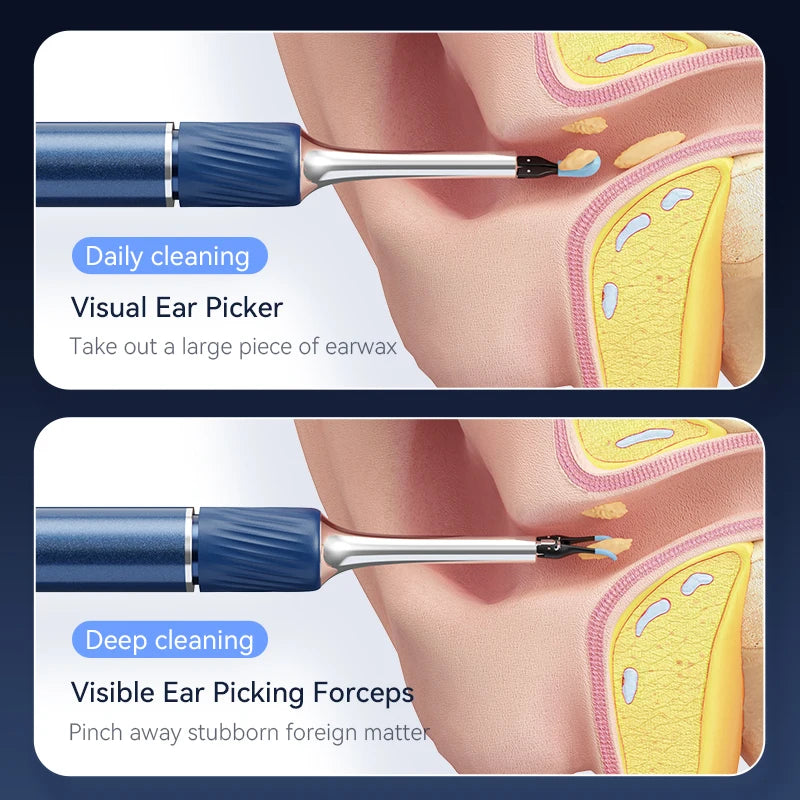 Viral Vault™ Ear Wax Removal Camera