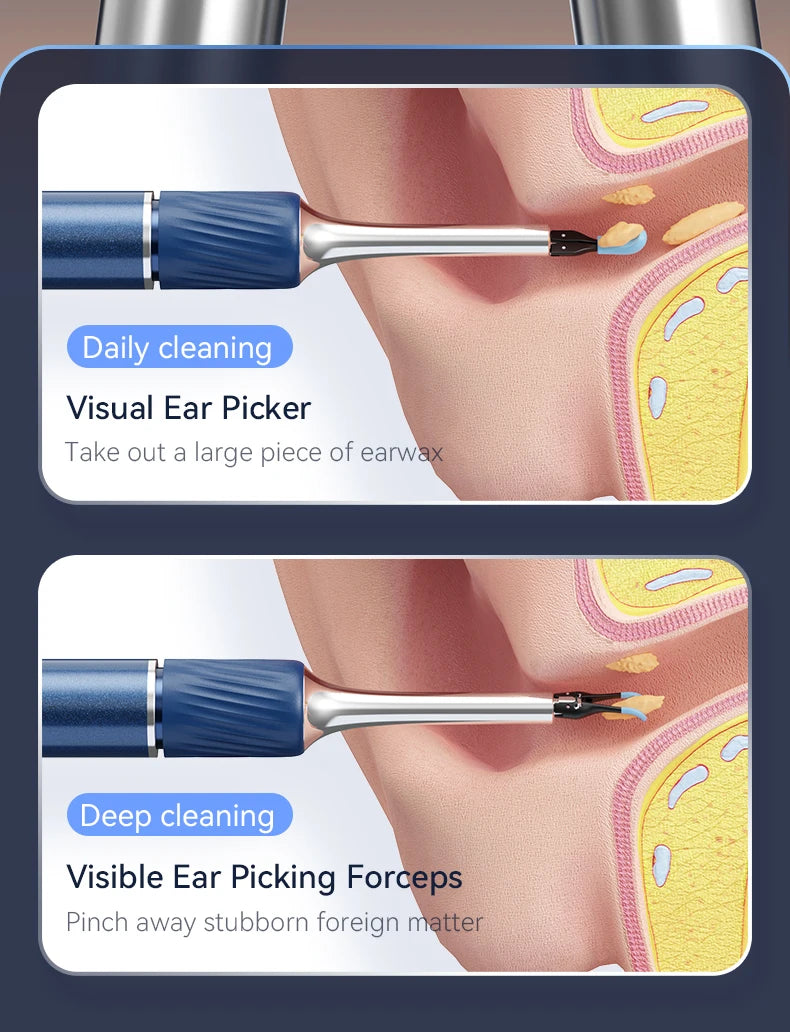 Viral Vault™ Ear Wax Removal Camera