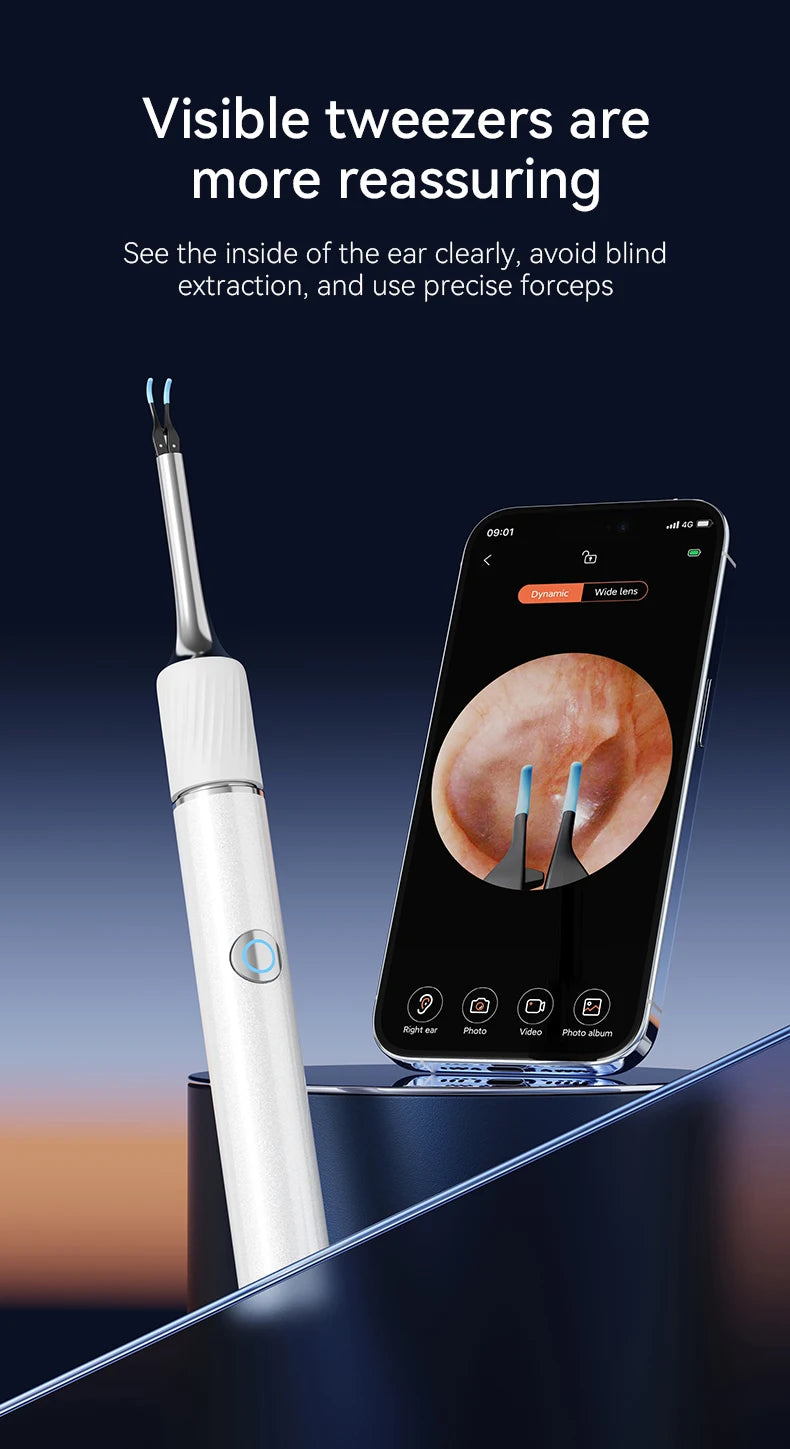 Viral Vault™ Ear Wax Removal Camera