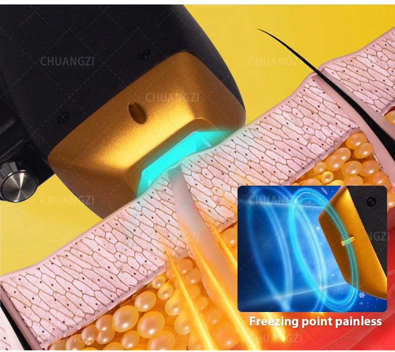 Viral Vault™ Professional Hair Removal Laser Machine