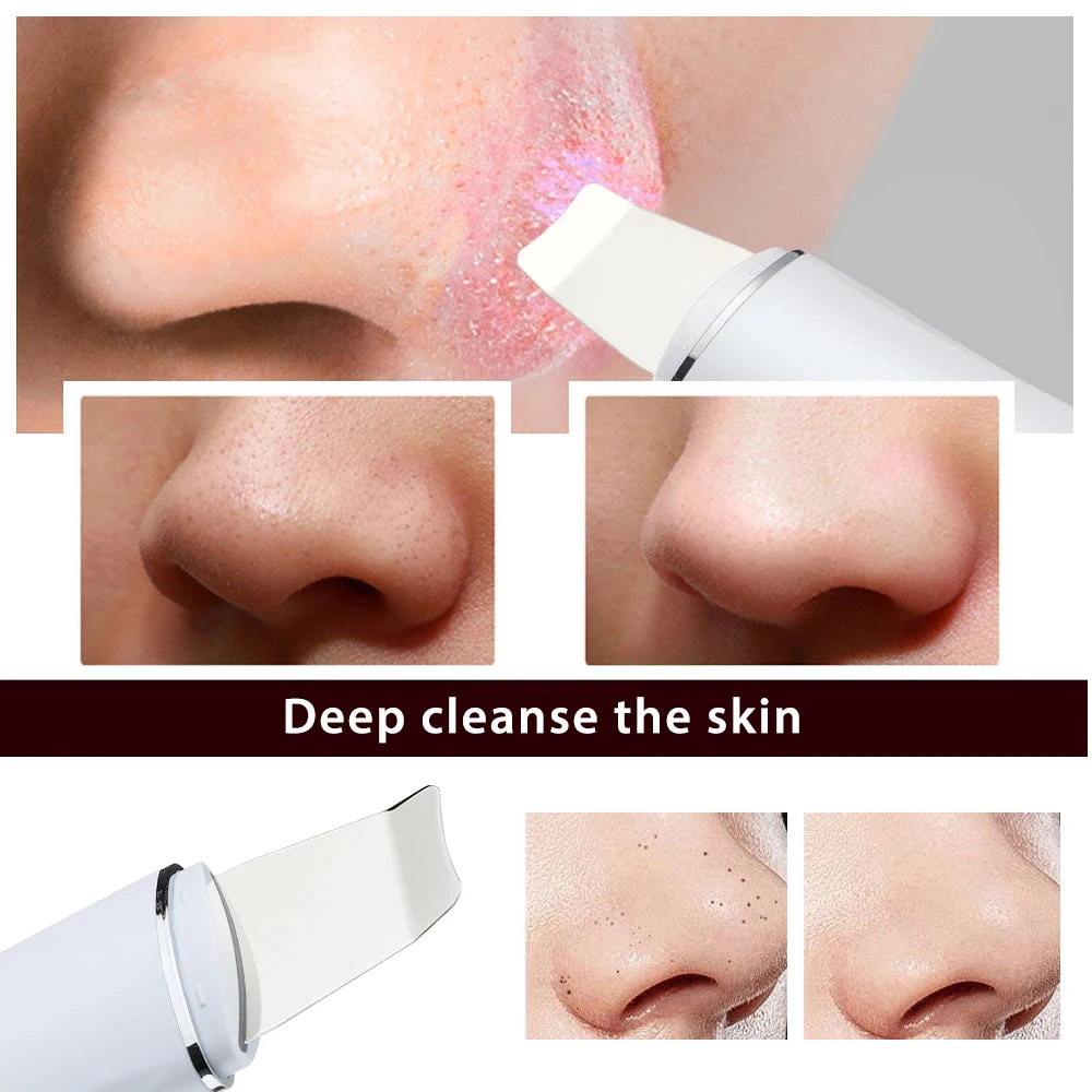 Viral Vault™ Ultrasonic Skin Scrubber