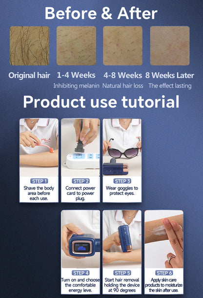 Viral Vault™ Laser Hair Removal Machine