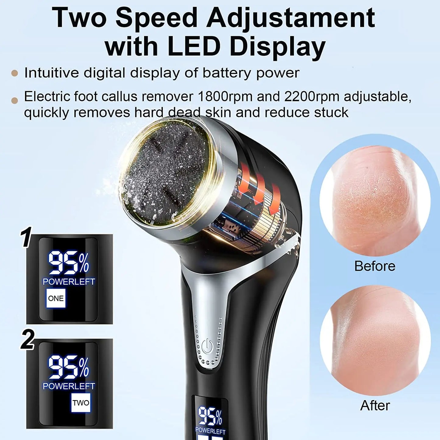 Viral Vault™  Electric  Dead Skin Care Tools