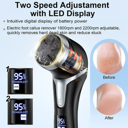 Viral Vault™  Electric  Dead Skin Care Tools