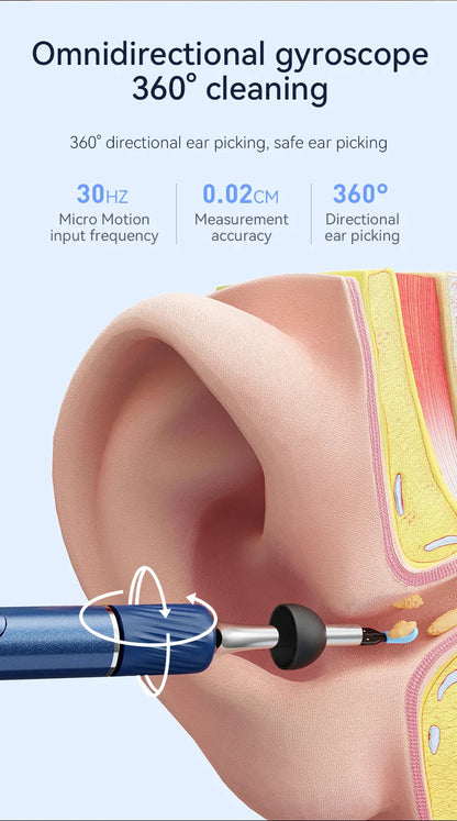 Viral Vault™ Ear Wax Removal Camera