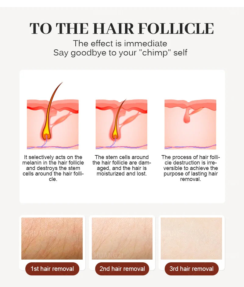 Viral Vault™ Professional Hair Removal Laser Machine