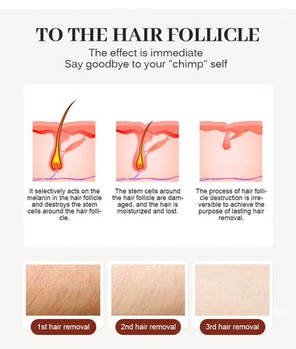 Viral Vault™ Professional Hair Removal Laser Machine
